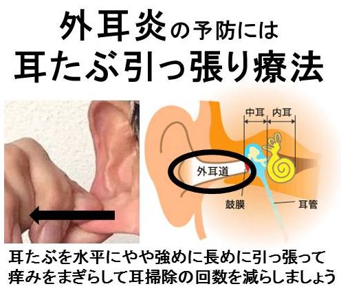外耳炎
